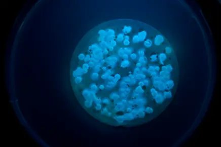 Pseudomonas Detection Pseudomonas Detection